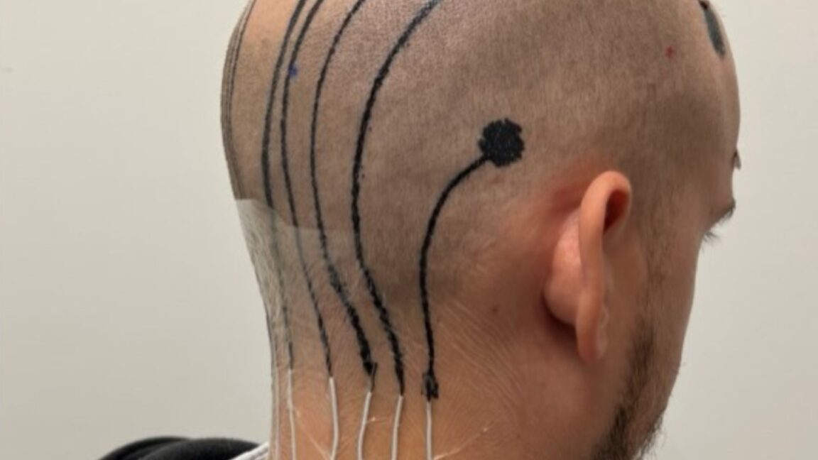 E-tattoos could make mobile EEGs a reality